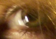 eye.jpg (228x159, 12Kb)