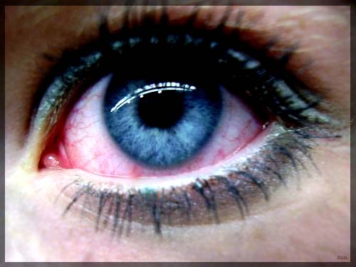  (500x375, 52Kb)