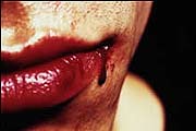 c229167-blood.jpg (180x120, 4Kb)