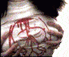  (100x83, 36Kb)