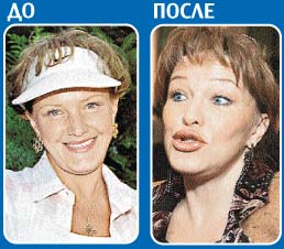 Елена воробей фото до и после пластики фото